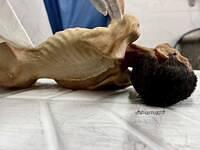 515435845 749725637809074 5482795902942047687 n