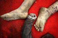 two Palestinian children killed in an Israeli airstrike on northern Gaza lie in the courtyard of Al-Shifa Hospital, on Sunday, May 18, 2025